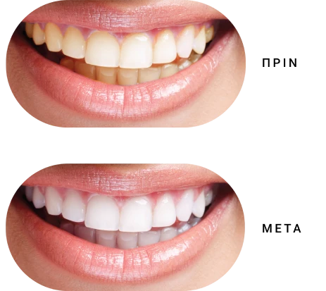 Smile Design Image
